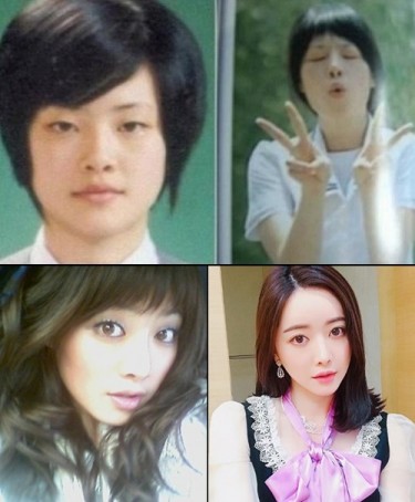 홍수아, 3단 성형 변천사? ‘급변한 얼굴...누군지 못 알아보겠네'