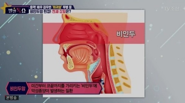 사진= TV 조선 캡쳐